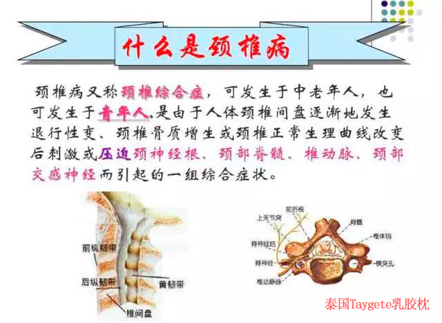 先来说说颈椎病 医学上是这么定义的: 颈椎病,是指颈椎椎间盘组织